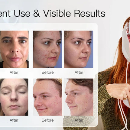 LED 7-Color Light Therapy Facial Mask – Skin Firming & Whitening - Glossorea