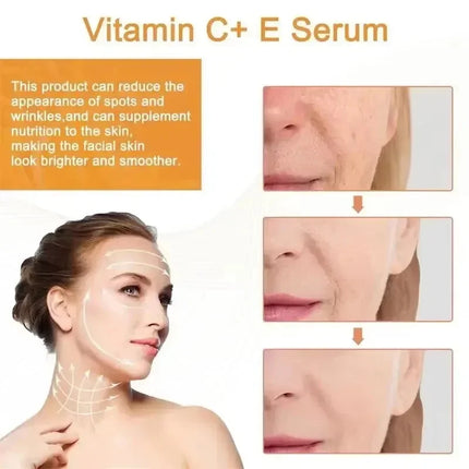 Vitamin C Whitening Serum – Dark Spot & Freckle Remover - Glossorea