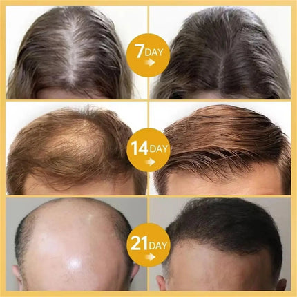 Ginger Hair Growth Oil – Anti-Hair Loss & Regrowth Treatment - Glossorea