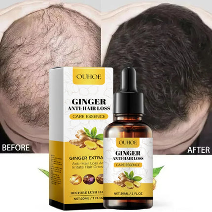 Ginger Hair Growth Oil – Anti-Hair Loss & Regrowth Treatment - Glossorea