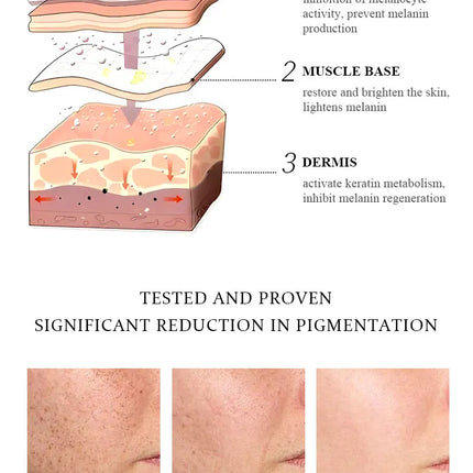 BELYN BERLY Turmeric Serum – Dark Spot Fade & Moisturizing (3pcs) - Glossorea