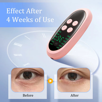 EMS Facial Massager – Microcurrent Lifting & Anti-Wrinkle Device - Glossorea