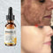 Vitamin C Whitening Serum – Dark Spot & Freckle Remover - Glossorea