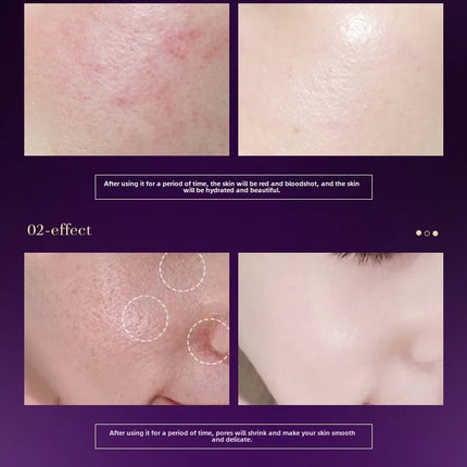 Niacinamide Peptide Serum – Firming & Pore Tightening - Glossorea