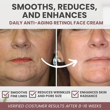 Instant Retinol Firming & Wrinkle Removal Cream - Glossorea