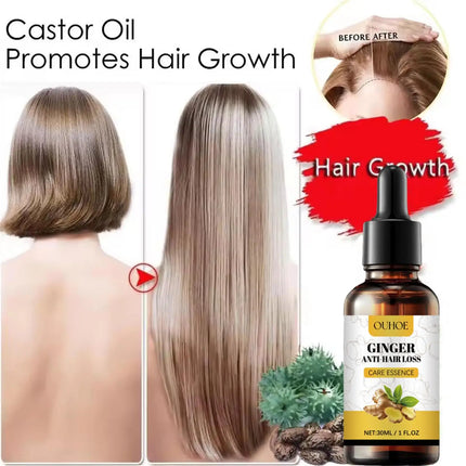 Ginger Hair Growth Oil – Anti-Hair Loss & Regrowth Treatment - Glossorea