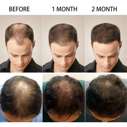 Ginger Hair Growth Oil – Anti-Hair Loss & Regrowth Treatment - Glossorea
