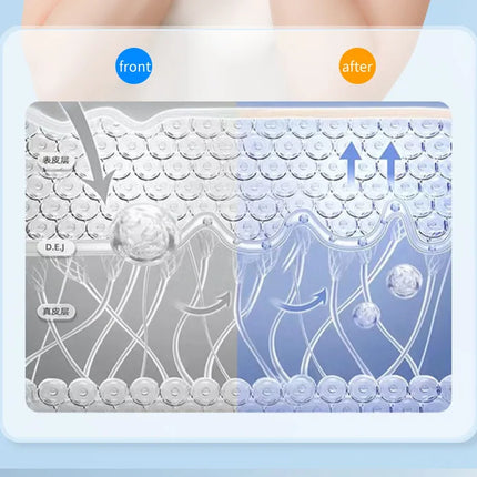 V-Line EMS Chin Massager – Double Chin Remover & Face Lifter - Glossorea