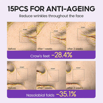 Retinol + Pro-Xylane Ampoule – Anti-Aging Repair (15pcs) - Glossorea