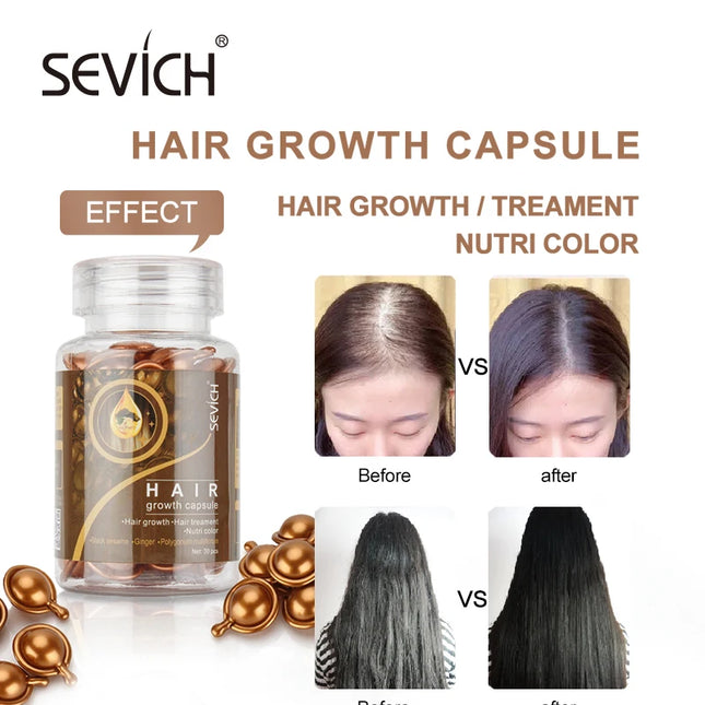30PCS Hair Growth Oil Capsules – Natural, Moisturizing & Restorative - Glossorea