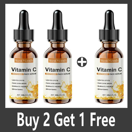 Vitamin C Whitening Serum – Dark Spot & Freckle Remover - Glossorea