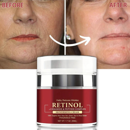 Instant Retinol Firming & Wrinkle Removal Cream - Glossorea