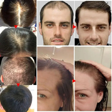 Ginger Hair Growth Oil – Anti-Hair Loss & Regrowth Treatment - Glossorea