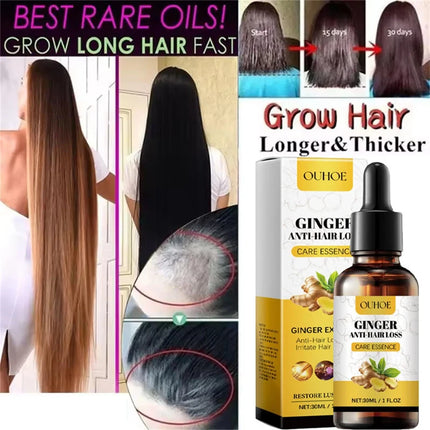 Ginger Hair Growth Oil – Anti-Hair Loss & Regrowth Treatment - Glossorea