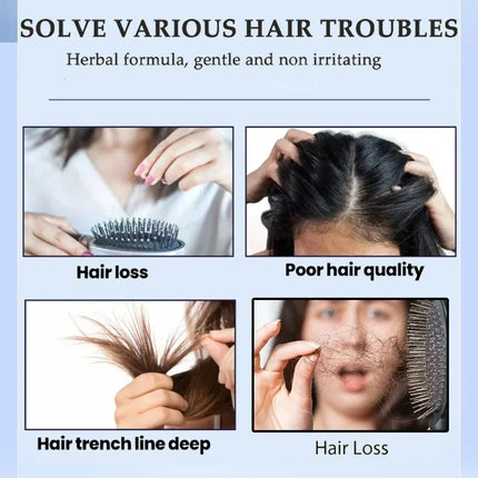 Hair Growth Serum – Anti-Hair Loss & Scalp Nourishing Oil - Glossorea
