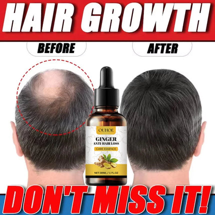 Ginger Hair Growth Oil – Anti-Hair Loss & Regrowth Treatment - Glossorea
