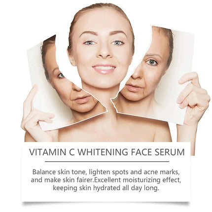Vitamin C Whitening Serum – Dark Spot & Freckle Remover - Glossorea