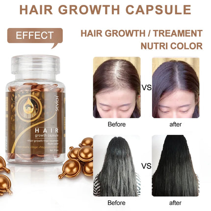 30PCS Hair Growth Oil Capsules – Natural, Moisturizing & Restorative - Glossorea