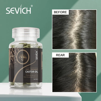 30PCS Hair Growth Oil Capsules – Natural, Moisturizing & Restorative - Glossorea