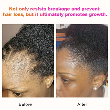 Sevich Hair Growth Set – Chebe Mask & Oil for Hair Loss Treatment - Glossorea