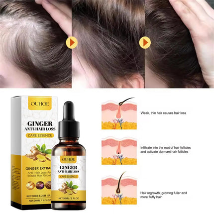 Ginger Hair Growth Oil – Anti-Hair Loss & Regrowth Treatment - Glossorea