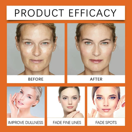Vitamin C Whitening Serum – Dark Spot & Freckle Remover - Glossorea