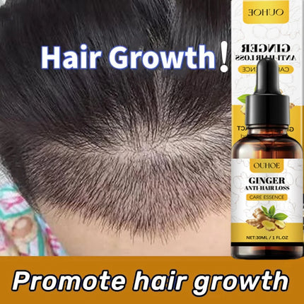 Ginger Hair Growth Oil – Anti-Hair Loss & Regrowth Treatment - Glossorea