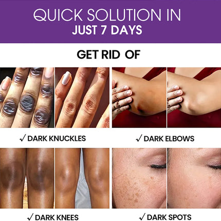 AILKE Dark Spot Serum – Brightening & Even Tone, 120ml - Glossorea