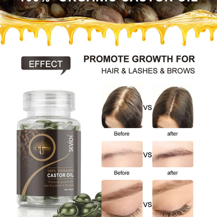 30PCS Hair Growth Oil Capsules – Natural, Moisturizing & Restorative - Glossorea