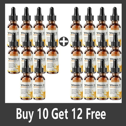 Vitamin C Whitening Serum – Dark Spot & Freckle Remover - Glossorea