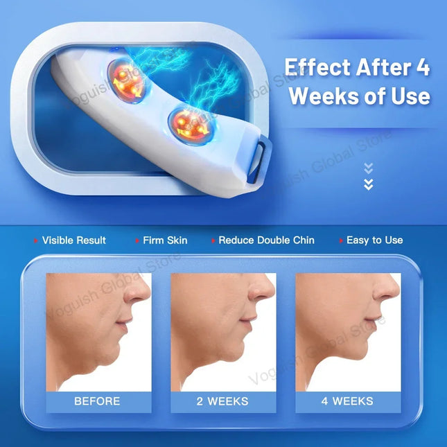 V-Line EMS Chin Massager – Double Chin Remover & Face Lifter - Glossorea
