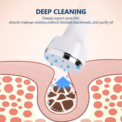 Foreverlily Ultrasonic Facial Machine – Lifting, Tightening & Pore Cleansing - Glossorea