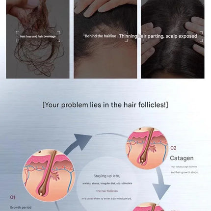 Hair Growth Serum – Anti-Hair Loss & Scalp Nourishing Oil - Glossorea