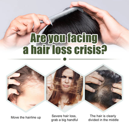 Ginger Hair Growth Oil – Anti-Hair Loss & Regrowth Treatment - Glossorea