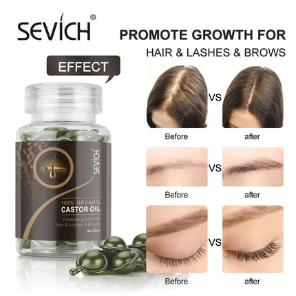 30PCS Hair Growth Oil Capsules – Natural, Moisturizing & Restorative - Glossorea